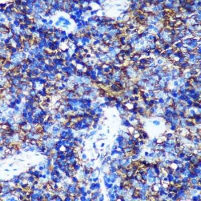 Immunohistochemistry-Paraffin: HEBP2 Antibody - Azide and BSA Free [NBP3-04517]