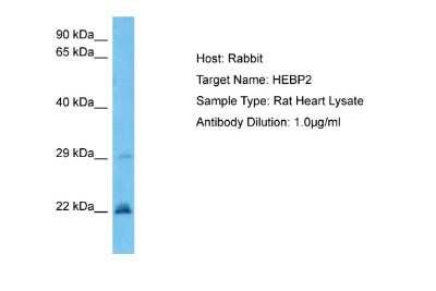 Western Blot: HEBP2 Antibody [NBP2-85037]