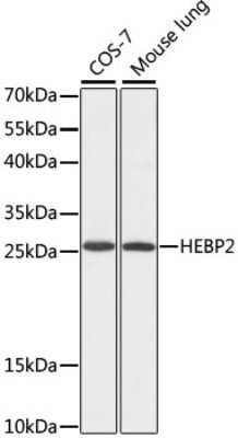 Western Blot: HEBP2 AntibodyAzide and BSA Free [NBP3-04517]