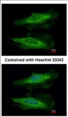 Immunocytochemistry/ Immunofluorescence: HECA Antibody [NBP2-16800]