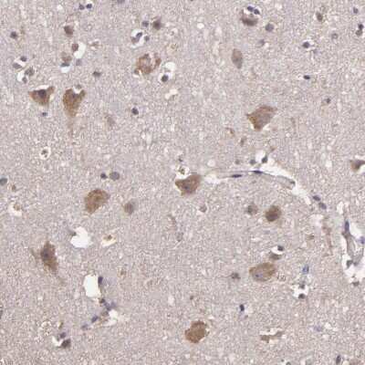 Immunohistochemistry-Paraffin: HECTD1 Antibody [NBP1-82926]