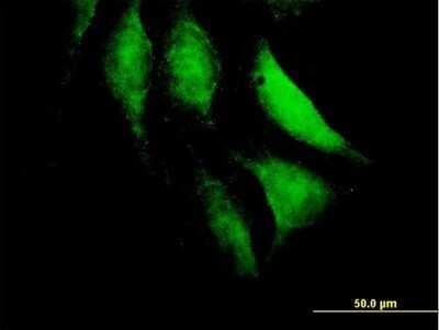 Immunocytochemistry/ Immunofluorescence: HECTD2 Antibody [H00143279-B01P]