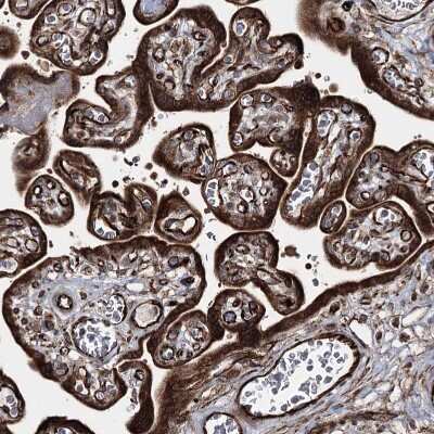 Immunohistochemistry-Paraffin: HECTD2 Antibody [NBP1-83481]