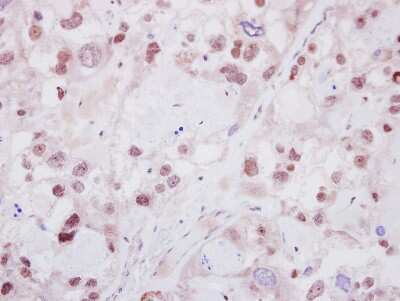 Immunohistochemistry-Paraffin: Helios Antibody [NBP2-16802]