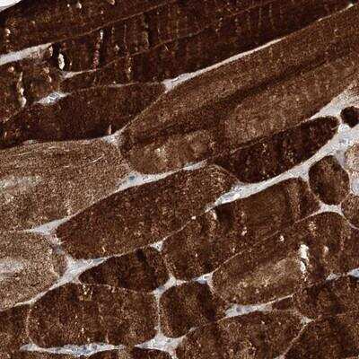 Immunohistochemistry: HELT Antibody [NBP1-90761]