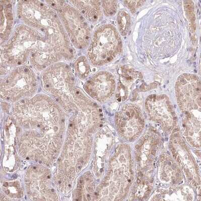 Immunohistochemistry-Paraffin: HELT Antibody [NBP2-38288]