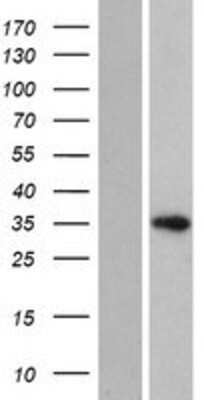 Western Blot: HELT Overexpression Lysate [NBP2-08601]