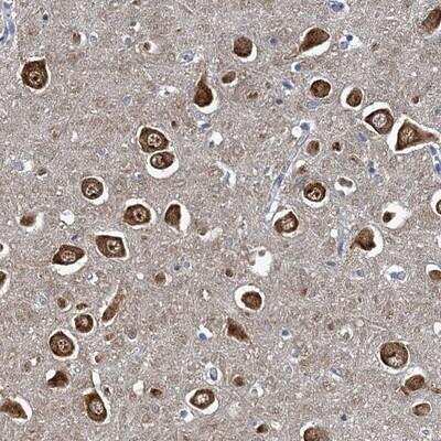 Immunohistochemistry: HEM1 Antibody [NBP2-13644]