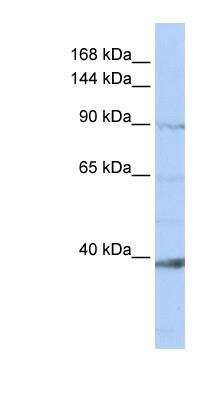 Western Blot: HEM1 Antibody [NBP1-79230]
