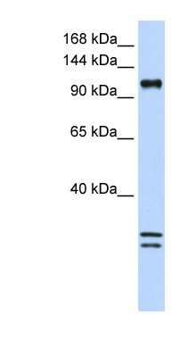 Western Blot: HEM1 Antibody [NBP1-79231]
