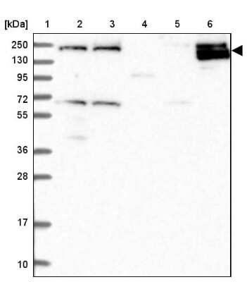 Western Blot: HEM1 Antibody [NBP2-13643]