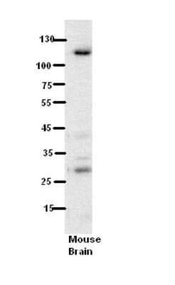 Western Blot: HEMK2 Antibody [NBP1-56486]