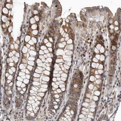 Immunohistochemistry-Paraffin: HENMT1 Antibody [NBP1-88330]
