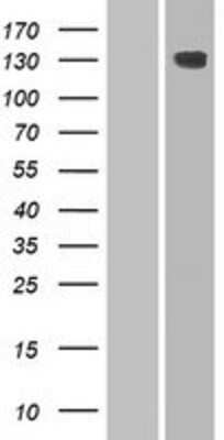 Western Blot: HEPHL1 Overexpression Lysate [NBP2-08326]