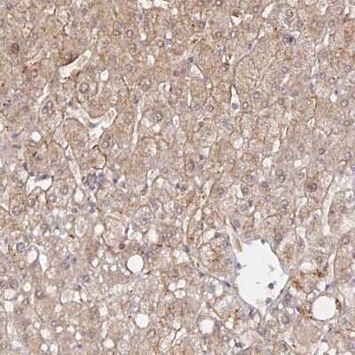 Immunohistochemistry-Paraffin: HEPN1 Antibody [NBP2-38014]