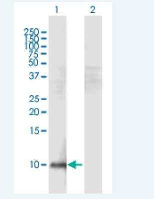 Western Blot: HEPN1 Antibody [H00641654-B01P-50ug]
