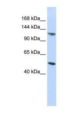 Western Blot: HERC5 Antibody [NBP1-58102]