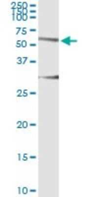 Immunoprecipitation: HERPUD1 Antibody (2G7) [H00009709-M04]