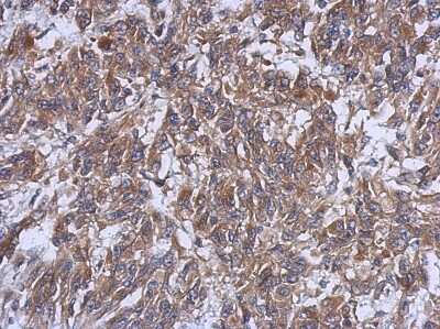 Immunohistochemistry-Paraffin: HERPUD1 Antibody [NBP2-16809]