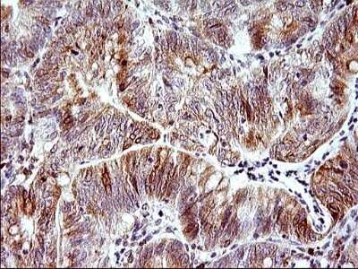 Immunohistochemistry: HERPUD1 Antibody (OTI1A2) - Azide and BSA Free [NBP2-71492]
