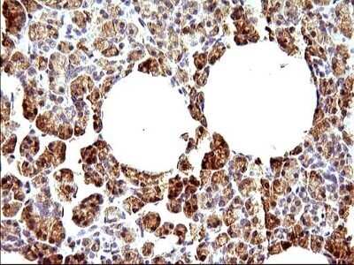 Immunohistochemistry: HERPUD1 Antibody (OTI1A2) - Azide and BSA Free [NBP2-71492]