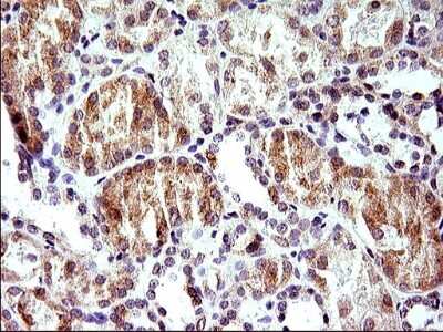 Immunohistochemistry: HERPUD1 Antibody (OTI1A2) [NBP2-45970]