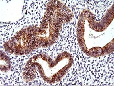 Immunohistochemistry: HERPUD1 Antibody (OTI1A2) [NBP2-45970]
