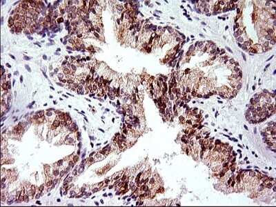 Immunohistochemistry: HERPUD1 Antibody (OTI1A2) [NBP2-45970]
