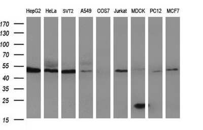 Western Blot: HERPUD1 Antibody (OTI1A2) [NBP2-45970]