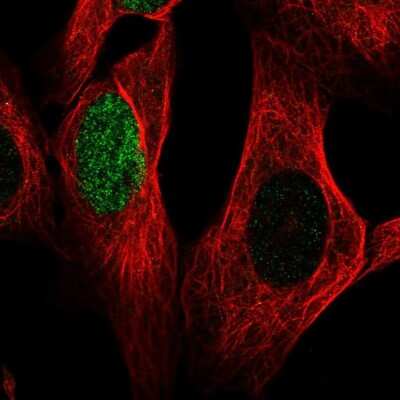 Immunocytochemistry/ Immunofluorescence: HES-1 Antibody [NBP2-68846]