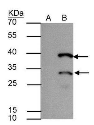 Immunoprecipitation: HES-1 Antibody [NBP1-30912]