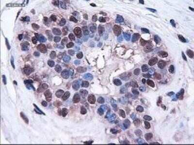 Immunohistochemistry: HES-1 Antibody (OTI4H1) - Azide and BSA Free [NBP2-70937]