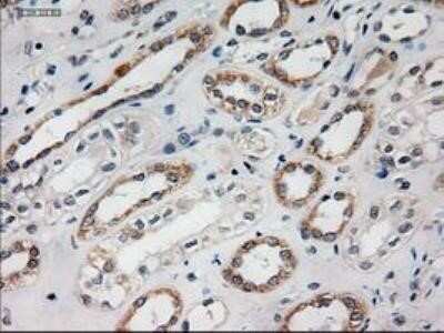 Immunohistochemistry: HES-1 Antibody (OTI4H1) - Azide and BSA Free [NBP2-70937]