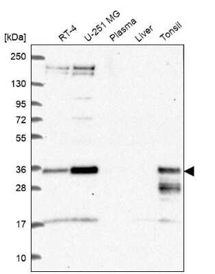 Western Blot: HES-1 Antibody [NBP2-68846]