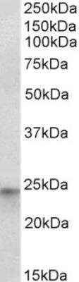 Western Blot: HES-4 Antibody [NBP2-42517]