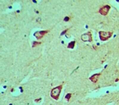 Immunohistochemistry-Paraffin: HES5 Antibody [NBP2-27174]