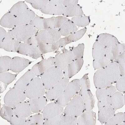 Immunohistochemistry-Paraffin: HESX1 Antibody [NBP1-89090]