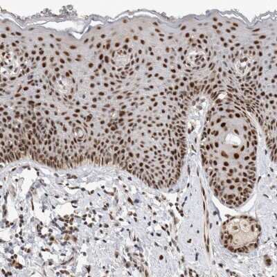 Immunohistochemistry-Paraffin: HESX1 Antibody [NBP1-89090]
