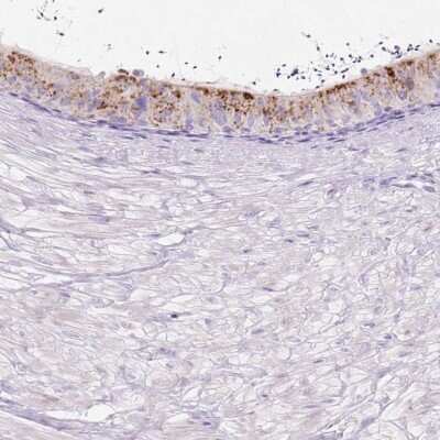Immunohistochemistry-Paraffin: HEXB Antibody [NBP2-48689]