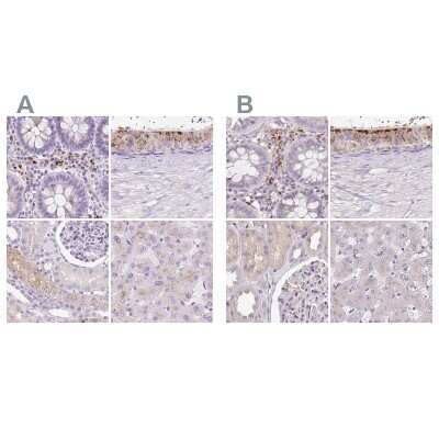 Immunohistochemistry-Paraffin: HEXB Antibody [NBP2-48689]