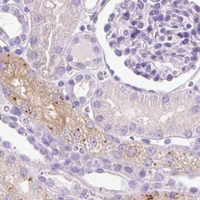 Immunohistochemistry-Paraffin: HEXB Antibody [NBP2-48689]