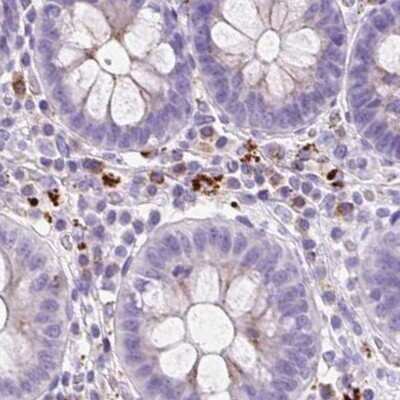 Immunohistochemistry-Paraffin: HEXB Antibody [NBP2-48689]