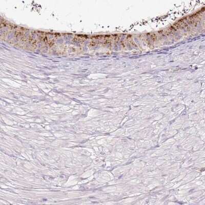 Immunohistochemistry-Paraffin: HEXB Antibody [NBP2-49211]