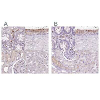 Immunohistochemistry-Paraffin: HEXB Antibody [NBP2-49211]