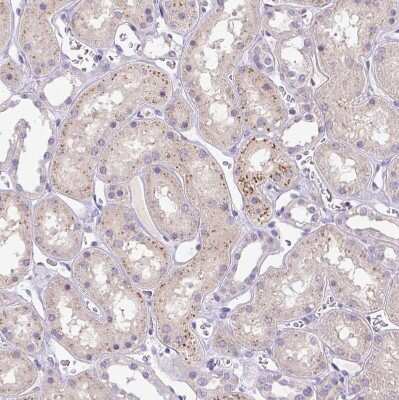 Immunohistochemistry-Paraffin: HEXB Antibody [NBP2-49211]