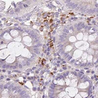 Immunohistochemistry-Paraffin: HEXB Antibody [NBP2-49211]