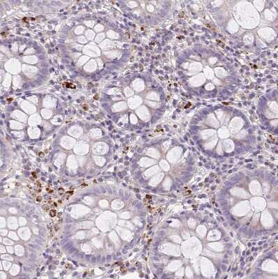 Immunohistochemistry-Paraffin: HEXB Antibody [NBP2-49211]