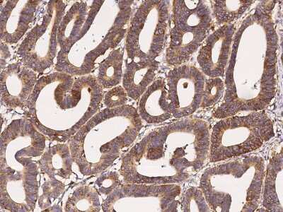 Immunohistochemistry-Paraffin: HEXB Antibody [NBP3-00084]