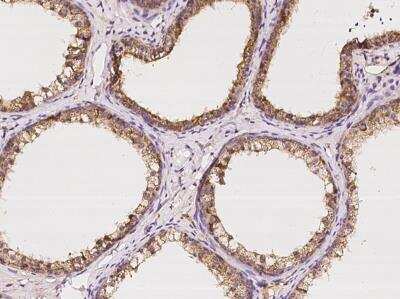 Immunohistochemistry-Paraffin: HEXB Antibody [NBP3-06429]