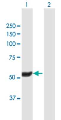 Western Blot: HEXDC Antibody [H00284004-B01P]